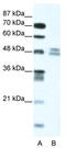 Thyroid Hormone Receptor Interactor 13 antibody, TA339092, Origene, Western Blot image 