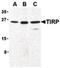 Toll Like Receptor Adaptor Molecule 2 antibody, PA5-20060, Invitrogen Antibodies, Western Blot image 