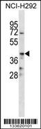 CD86 antibody, 58-262, ProSci, Western Blot image 