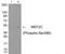 Myocyte Enhancer Factor 2C antibody, 79-917, ProSci, Western Blot image 