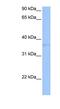 Triggering Receptor Expressed On Myeloid Cells Like 2 antibody, NBP1-70737, Novus Biologicals, Western Blot image 