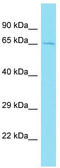 Coiled-Coil Domain Containing 173 antibody, TA334109, Origene, Western Blot image 