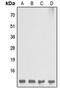 Diazepam Binding Inhibitor, Acyl-CoA Binding Protein antibody, abx121589, Abbexa, Western Blot image 