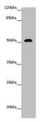 Serine Carboxypeptidase 1 antibody, LS-C679405, Lifespan Biosciences, Western Blot image 