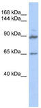 G Protein-Coupled Receptor Associated Sorting Protein 2 antibody, TA340292, Origene, Western Blot image 