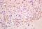 RAD21 Cohesin Complex Component antibody, orb100862, Biorbyt, Immunohistochemistry paraffin image 