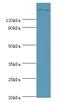 Rho Associated Coiled-Coil Containing Protein Kinase 2 antibody, MBS1492984, MyBioSource, Western Blot image 