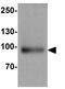 SUZ12 Polycomb Repressive Complex 2 Subunit antibody, GTX31909, GeneTex, Western Blot image 