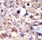 ABL Proto-Oncogene 1, Non-Receptor Tyrosine Kinase antibody, LS-C99160, Lifespan Biosciences, Immunohistochemistry paraffin image 