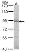Dipeptidyl Peptidase 8 antibody, GTX105200, GeneTex, Western Blot image 