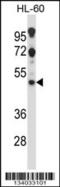 5-hydroxytryptamine receptor 2C antibody, 57-337, ProSci, Western Blot image 