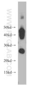 Aquaporin 1 (Colton Blood Group) antibody, 20333-1-AP, Proteintech Group, Western Blot image 