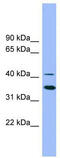 GATA Binding Protein 5 antibody, TA329360, Origene, Western Blot image 