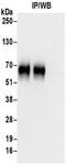 CD226 Molecule antibody, NBP2-32247, Novus Biologicals, Immunoprecipitation image 
