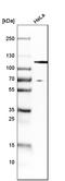 Hepatocyte Growth Factor-Regulated Tyrosine Kinase Substrate antibody, HPA007728, Atlas Antibodies, Western Blot image 