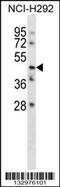 Transmembrane Protein 102 antibody, 58-260, ProSci, Western Blot image 