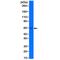 Keratin 5 antibody, GTX33612, GeneTex, Western Blot image 