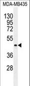 Lipase Family Member K antibody, LS-C165796, Lifespan Biosciences, Western Blot image 