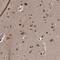 Zinc Finger Protein 518B antibody, PA5-56677, Invitrogen Antibodies, Immunohistochemistry frozen image 