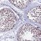Ferredoxin 2 antibody, HPA043986, Atlas Antibodies, Immunohistochemistry frozen image 