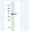 Orthopedia Homeobox antibody, H00023440-M03-100ug, Novus Biologicals, Western Blot image 