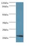 ADP Ribosylation Factor 3 antibody, LS-C375239, Lifespan Biosciences, Western Blot image 