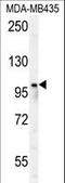 Poly(ADP-Ribose) Polymerase Family Member 8 antibody, LS-C163376, Lifespan Biosciences, Western Blot image 