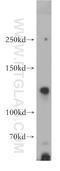 Neuronal Cell Adhesion Molecule antibody, 21608-1-AP, Proteintech Group, Western Blot image 