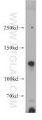 Neuronal cell adhesion molecule antibody, 21608-1-AP, Proteintech Group, Western Blot image 