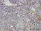 FGR Proto-Oncogene, Src Family Tyrosine Kinase antibody, LS-C133195, Lifespan Biosciences, Immunohistochemistry paraffin image 