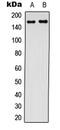 CF Transmembrane Conductance Regulator antibody, MBS8208382, MyBioSource, Western Blot image 