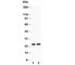 Sodium Voltage-Gated Channel Beta Subunit 1 antibody, R30346, NSJ Bioreagents, Western Blot image 