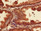 Proteasome Subunit Alpha 7 antibody, LS-C211123, Lifespan Biosciences, Immunohistochemistry frozen image 