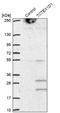 Tctex1 Domain Containing 1 antibody, NBP1-93777, Novus Biologicals, Western Blot image 