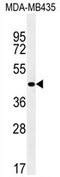 Zinc Finger Protein 625 antibody, AP54703PU-N, Origene, Western Blot image 