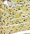 Aryl Hydrocarbon Receptor antibody, PA1782-2, Boster Biological Technology, Immunohistochemistry frozen image 