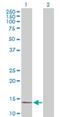 Ribosomal Protein Lateral Stalk Subunit P1 antibody, H00006176-B01P, Novus Biologicals, Western Blot image 