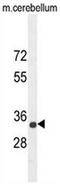 SYNCAM antibody, AP50711PU-N, Origene, Western Blot image 