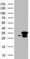 RNA Transcription, Translation And Transport Factor antibody, CF803840, Origene, Western Blot image 