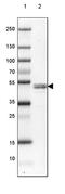 Reticulocalbin 2 antibody, PA5-56542, Invitrogen Antibodies, Western Blot image 