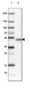 Reticulocalbin-2 antibody, PA5-56542, Invitrogen Antibodies, Western Blot image 