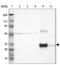 Mannose Binding Lectin 2 antibody, NBP1-85518, Novus Biologicals, Western Blot image 