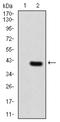 Telomerase Reverse Transcriptase antibody, M00012-1, Boster Biological Technology, Western Blot image 