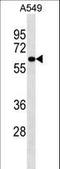 Phosphatidylinositol Glycan Anchor Biosynthesis Class S antibody, LS-C158660, Lifespan Biosciences, Western Blot image 