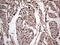 Meis Homeobox 1 antibody, LS-C795043, Lifespan Biosciences, Immunohistochemistry paraffin image 