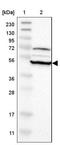 Ring Finger Protein 130 antibody, NBP1-81858, Novus Biologicals, Western Blot image 