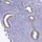 SMAD Family Member 5 antibody, NBP2-32406, Novus Biologicals, Immunohistochemistry paraffin image 