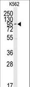 Mitogen-Activated Protein Kinase 7 antibody, LS-C99955, Lifespan Biosciences, Western Blot image 