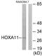 Homeobox A11 antibody, PA5-39209, Invitrogen Antibodies, Western Blot image 