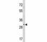 Snail Family Transcriptional Repressor 1 antibody, F53501-0.1ML, NSJ Bioreagents, Immunohistochemistry paraffin image 